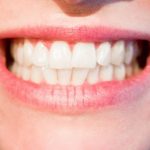8 Flawless Home Treatments For Cavities