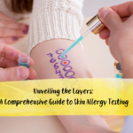 Unveiling the Layers: A Comprehensive Guide to Skin Allergy Testing